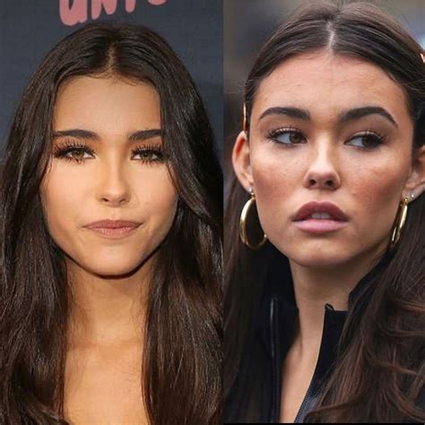 madison beer plastic sugery|Madison Beer Plastic Surgery: Quotes, Before, After。